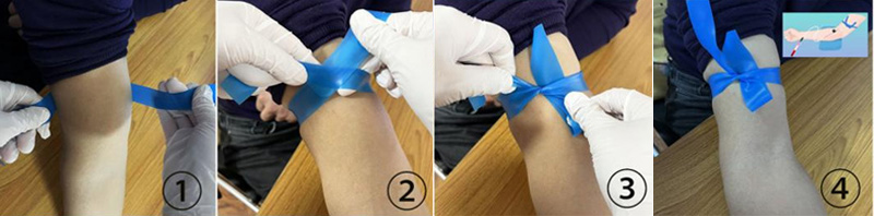 TPE Surgical Tourniquet